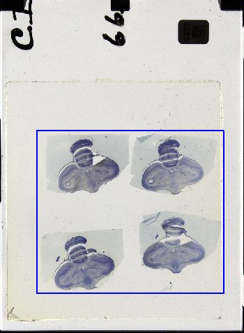Media type: image; Special Collections 3298   shows specimen_part histological serial section;